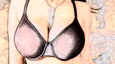 乳房下垂矫正的*果怎么样?乳房下垂矫正手术前后图片
