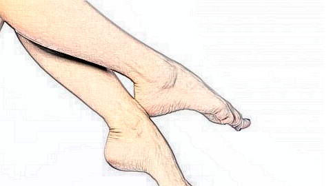小腿吸脂副作用是什么? 小腿吸脂有哪些后遗症?