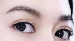 武汉美莱的刘扬做双眼皮怎么样?双眼皮手术案例及