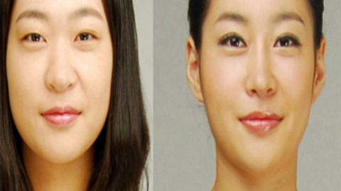 上海鼻修复厉害医生哪个比较好?上海鼻子修复专家排名推荐