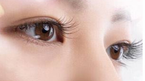 新疆医学院做双眼皮怎么样?双眼皮医生哪个割的好?附案例