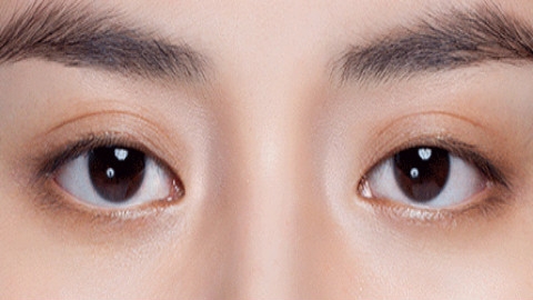 上海双眼皮修复哪个医生比较好?上海双眼皮修复专家排名名单推荐