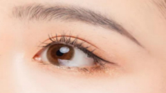 西安美立方双眼皮做的怎么样?附双眼皮整形案例及