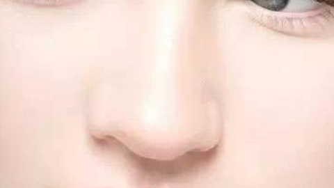 重庆花都整形王量鼻修复怎么样?鼻部多项手术修复案例,还您美美的鼻子!