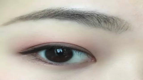 北京美天做双眼皮怎么样?做双眼皮手术案例,怎么看都好!
