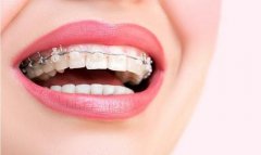 口腔医院牙齿矫正2021_牙齿矫正有几种方式和