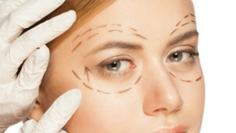 成都温妮莎医学美容做双眼皮手术怎么样?成都温妮莎医学美容做双眼皮手术案例及价格
