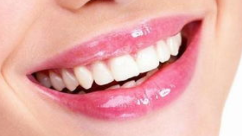 牙齿整形用哪种牙托好?用隐形的好还是钢丝的好?