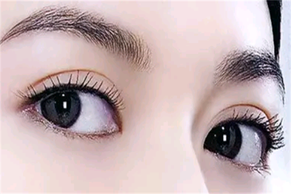 2021上海第六人民医院割双眼皮费用多少?割双眼皮医生推荐