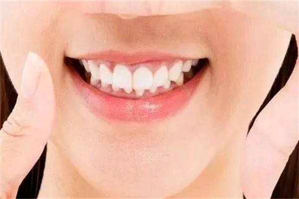 2021山东省立医院牙科整形需要多少费用?牙科整形医生推荐