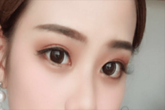 武汉天佑医院2021做双眼皮怎么样?做双眼皮价目表