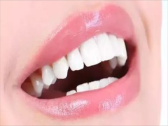 2021保定矫正牙齿医院排名榜发布