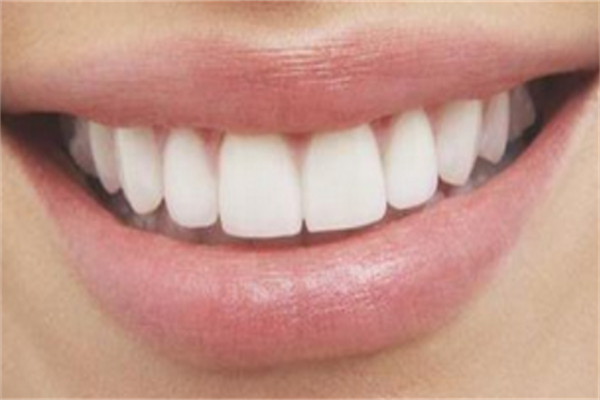 2021新疆医科大学第二附属医院牙齿矫正价目表(价格)怎么样【牙齿矫正整形案例】