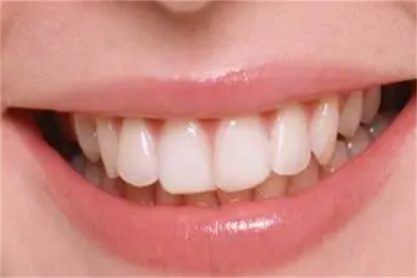 2021湘雅二医院种植牙价位多少?口腔种植牙专家有哪些