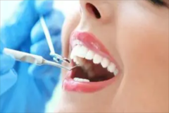 湘雅二医院牙齿美白能做吗?牙齿美白哪个医生好2021