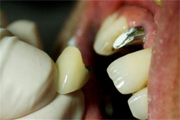 陕西省人民医院牙齿矫正多少钱?牙齿矫正医生名单