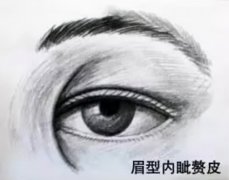 北京清华大学玉泉医院纪柳：什么人群适合开眼角手术，会不会留疤？