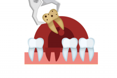 扬州市第一人民医院种植牙是多少?半口种植牙医生哪个好