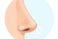 为什么做完耳软骨隆鼻/鼻部多项后鼻尖显形了？怎么办？