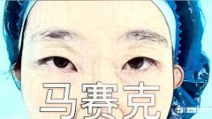 广州全切双眼皮手术,重睑术,过程分享，超无广告！！