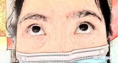 南方医科大学深圳医院去眼袋手术案例分享+恢复过程图