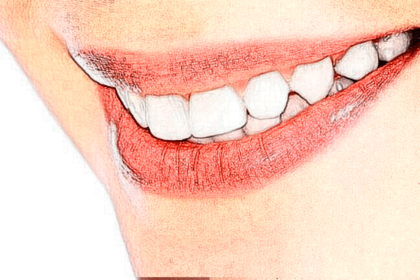 2022长沙科尔雅口腔医院多颗牙种植靠谱吗?多颗牙种植专家有谁