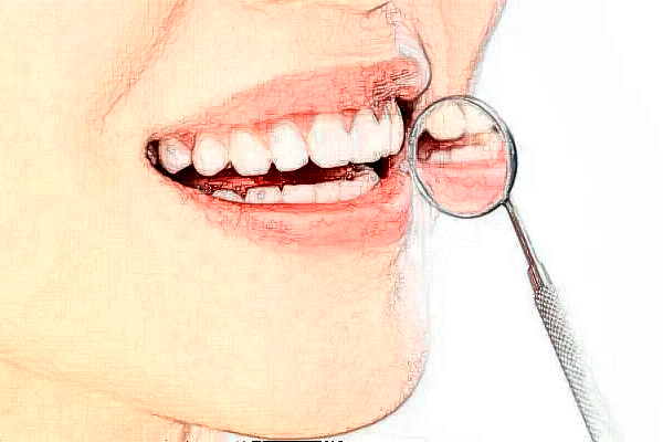 西昌牙博士口腔门诊部超声波洁牙做的好吗?哪位医生做得好