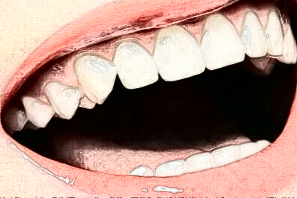武汉牙达人口腔医院牙齿修复好吗|专家医生|案例分享
