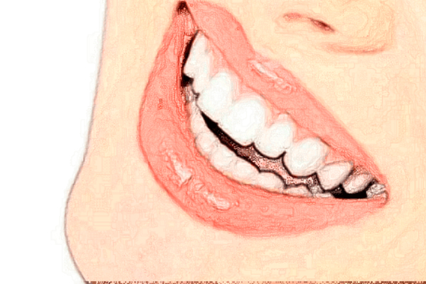 天津河西区诺尔牙齿不齐技术好吗?牙齿不齐专家有谁