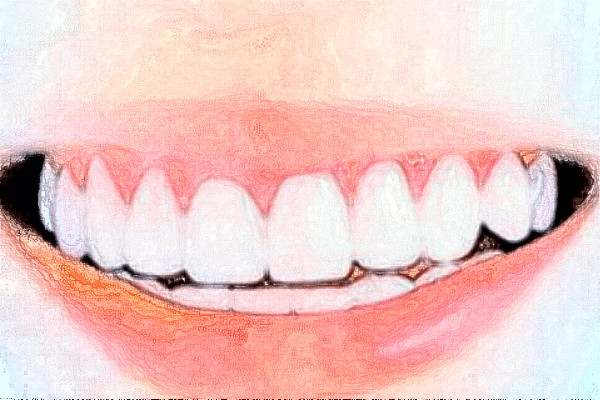 杭州民利健康管理牙齿不齐技术好吗?牙齿不齐专家有谁