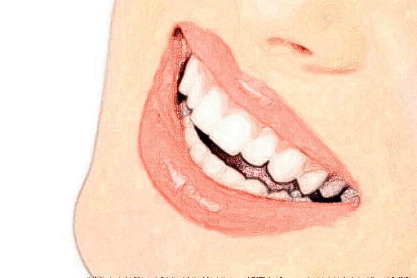 杭州民利健康管理牙齿不齐技术好吗?牙齿不齐专家有谁