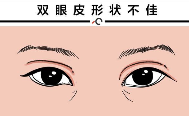 上海九院眼窝凹陷填充哪个医生技术擅长?多少钱?专家介绍