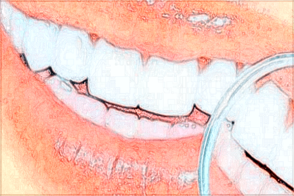 西安未央中诺口腔医院全口牙技术好吗?案例展示