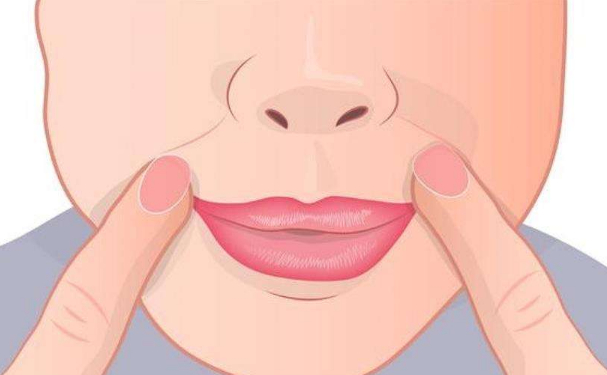 嘴角开大会有什么影响?嘴角开大能维持几年