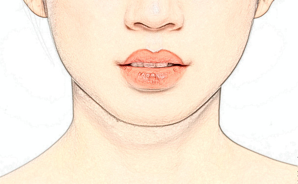 嘴角开大会有什么影响?嘴角开大能维持几年
