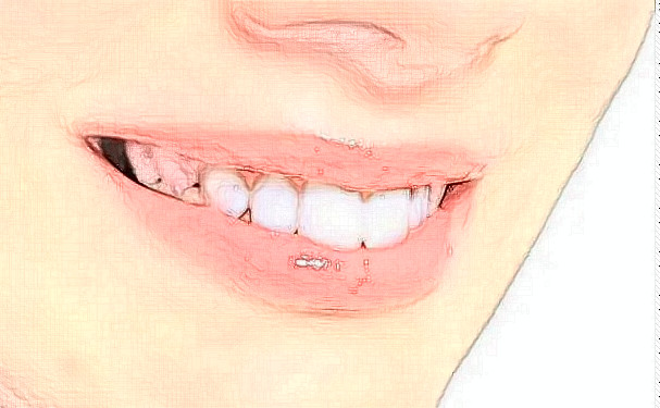 上海市黄浦区第二牙病防治所口腔科看牙齿水平如何?专家团队简介,含价格多少