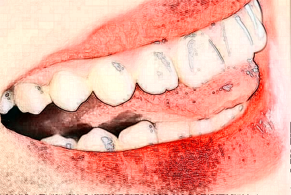 天津医科大学总医院牙齿种植详细信息分享