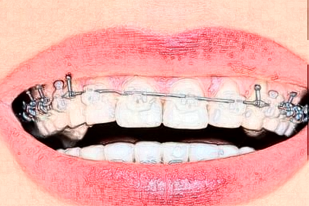 福建省立医院牙齿矫修复能做吗