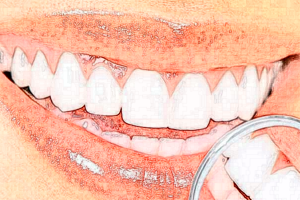福建省立医院牙齿正畸几位医生能做