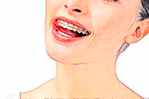 吉林省人民医院牙齿整形专业吗