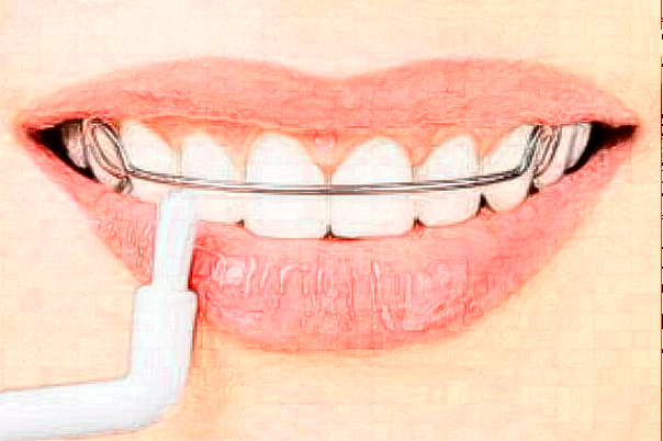 吉林省人民医院牙齿美白几位医生能做