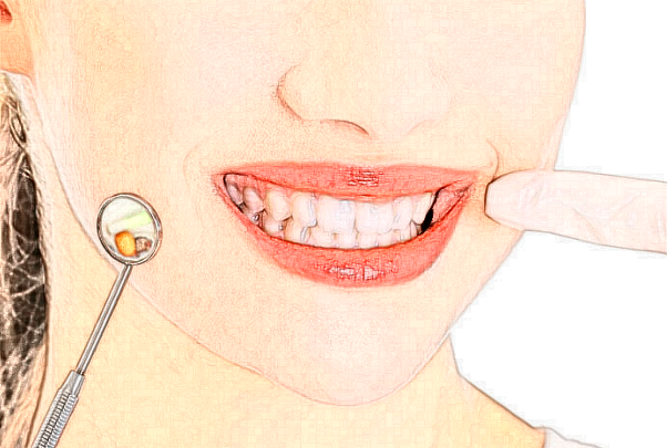 重庆医科大学附属大学城医院牙齿瓷贴面值得相信吗