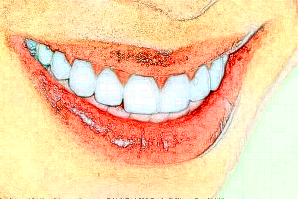 吉林市口腔医院龅牙矫正手术攻略