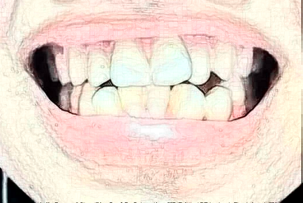 温州市人民医院种植牙专业医生是谁