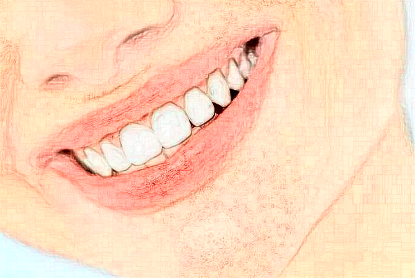 瑞安市人民医院全口牙种植高水平医生