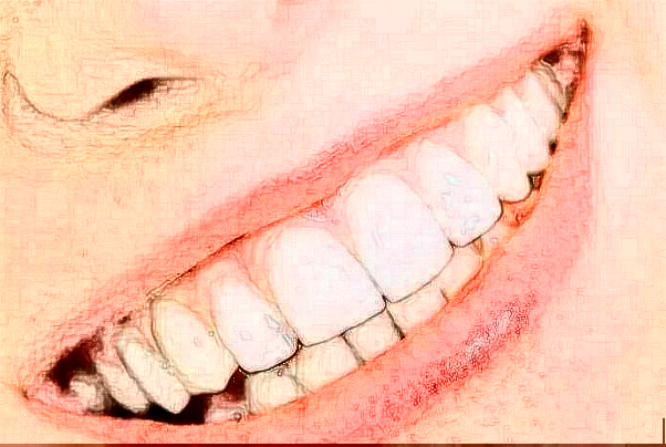 吉林市口腔医院多颗牙种植高赞医生分享