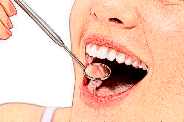 吉林大学口腔医院多颗牙种植正规吗