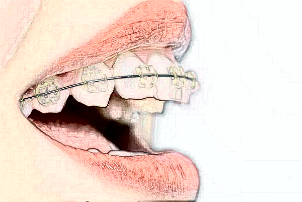 西宁市第一人民医院牙齿种植预约流程