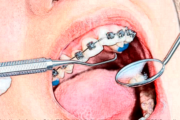 佛山市口腔医院牙齿整形医生分析