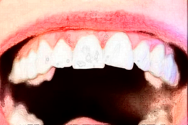 泰安市口腔医院牙齿矫正修复口碑实力怎么样